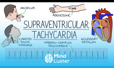 Understanding Supraventricular Tachycardia SVT
