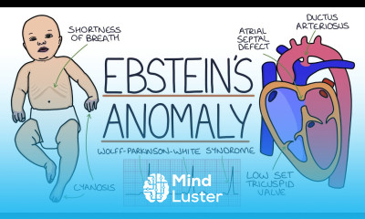 Understanding Ebstein s Anomaly