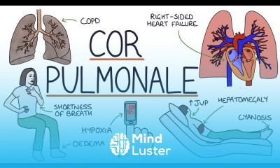 Understanding Cor Pulmonale