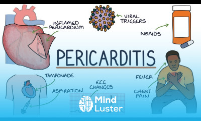 Understanding Pericarditis