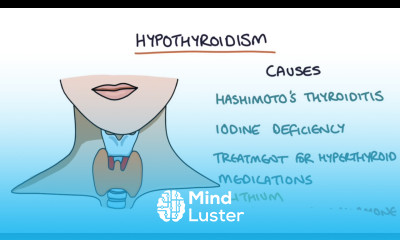 Hypothyroidism and Hashimoto s Thyroiditis Visual Explanation for Students