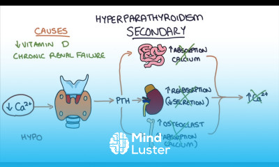 Understanding Hyperparathyroidism