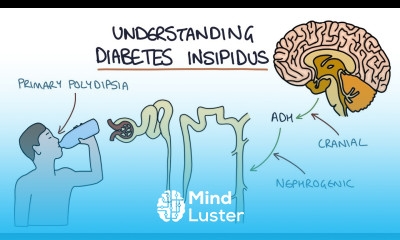 Understanding Diabetes Insipidus
