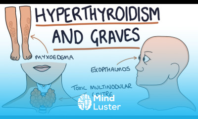 Understanding Hyperthyroidism and Graves Disease