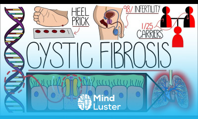 Understanding Cystic Fibrosis Includes Pathophysiology Diagnosis