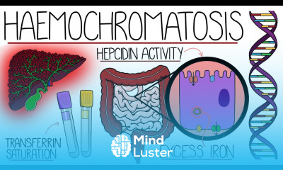 Understanding Haemochromatosis Hereditary Secondary