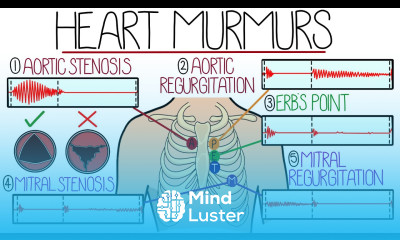 Learn Heart Murmurs In 10 Minutes With Heart Murmur Sounds