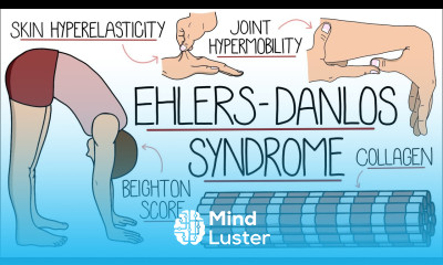 Ehlers Danlos Syndrome Explained Clearly