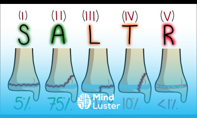 Salter Harris Classification Made Easy To Remember