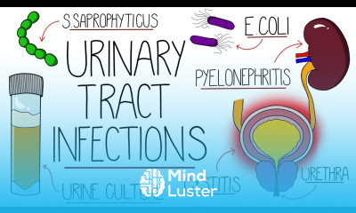 UTI Made Easy Urinary Tract Infections Explained Clearly
