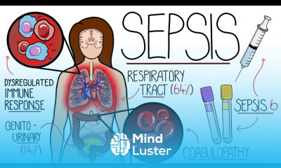 Understanding Sepsis Sepsis Explained Clearly