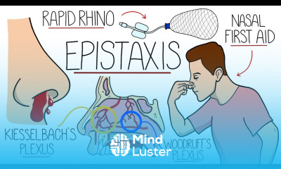 Understanding Epistaxis Nosebleeds Explained