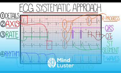 ECG Interpretation Made Easy Learn How to Interpret an ECG in 13 Minutes