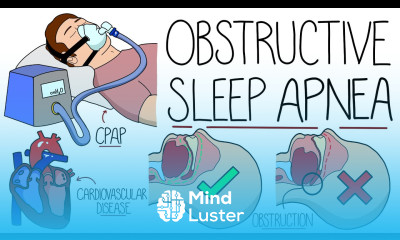 Understanding Obstructive Sleep Apnea Syndrome