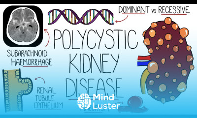 Polycystic Kidney Disease Explained