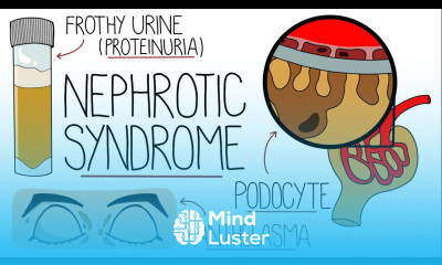 Nephrotic Syndrome Explained Clearly