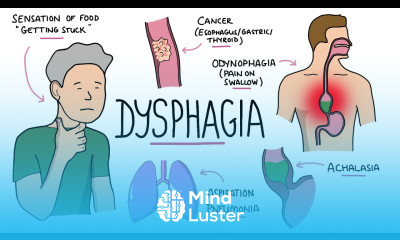 Dysphagia Oropharyngeal Esophageal Dysphagia Causes Differential Diagnosis Signs Treatment