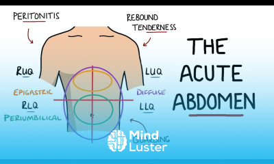 Acute Abdomen A Guide to Acute Abdominal Pain