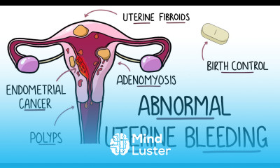 Abnormal Uterine Bleeding AUB Menorrhagia Heavy Menstrual Bleeding Including Mnemonic