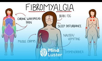 Fibromyalgia A Chronic Pain Disorder Includes Symptoms Criteria Treatment Options