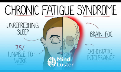 Myalgic Encephalomyelitis Chronic Fatigue Syndrome Includes Criteria Treatment
