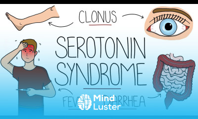 Serotonin Syndrome Explained Serotonin Toxicity