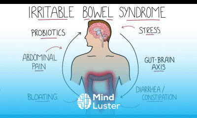 Irritable Bowel Syndrome IBS Including Symptoms Criteria Treatment