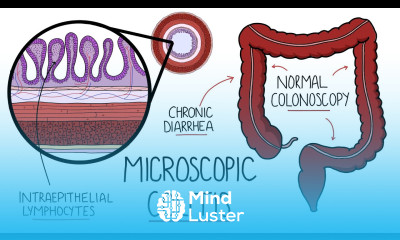 Microscopic Colitis Lymphocytic Collagenous Colitis An Underdiagnosed Form of IBD