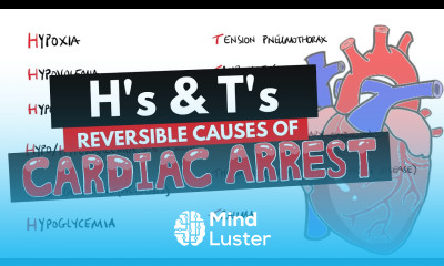 Reversible Causes of Cardiac Arrest Hs and Ts Mnemonic H s T s Mnemonic