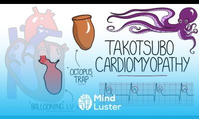 Takotsubo Cardiomyopathy Explained Broken Heart Syndrome