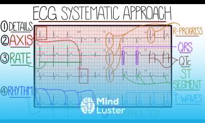 ECG Interpretation Made Easy Learn How to Interpret an ECG in 13 Minutes