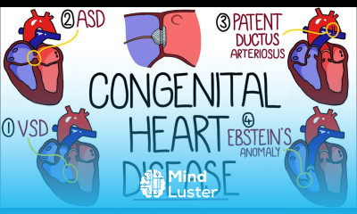 Congenital Heart Malformations Made Easy 8 Main Types