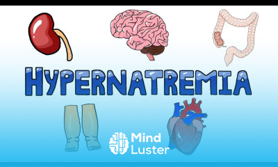An Approach to Hypernatremia Hypernatremia Diagnostic Algorithm Hypernatremia Causes MADE EASY