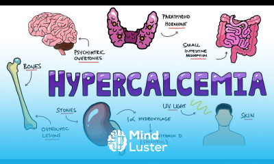 An Approach to Hypercalcemia Causes Calcium Homeostasis Mechanisms Signs and Symptoms Mnemonic