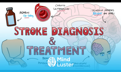 Stroke Diagnosis and Treatment Acute and Long Term Treatment of Ischemic and Hemorrhagic Stroke