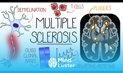 Understanding Multiple Sclerosis Multiple Sclerosis Explained