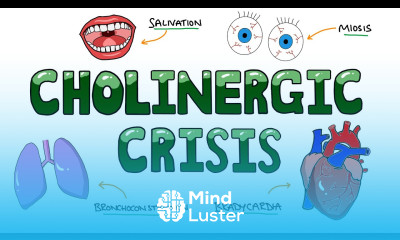 Signs and Symptoms of Cholinergic Crisis DUMBBELLS Mnemonic