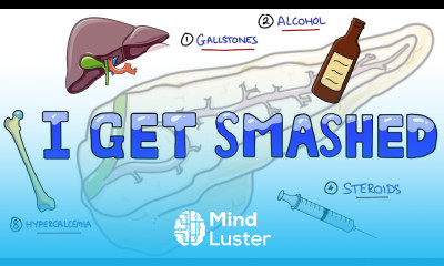 Causes of Acute Pancreatitis Mnemonic I GET SMASHED What are the causes of Acute Pancreatitis