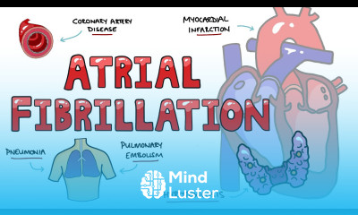 Atrial Fibrillation Causes Mnemonic PIRATES What are the causes of Atrial Fibrillation