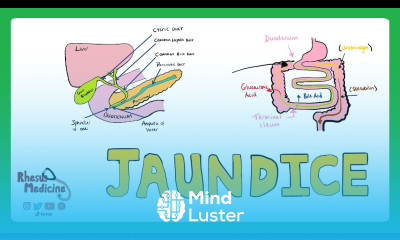 JAUNDICE Differential diagnosis of Jaundice Prehepatic Hepatic Post Hepatic Causes of Jaundice