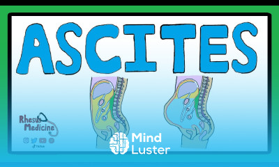 ASCITES Serum Ascites Albumin Gradient SAAG Ascites Pathophysiology Ascites Causes