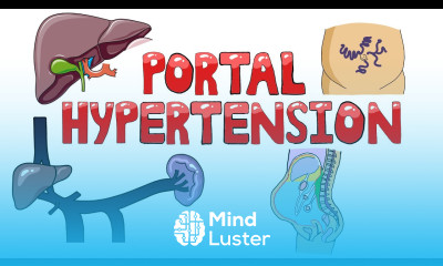 Portal Hypertension Causes of Portal Hypertension Pre Intra Post Hepatic Symptoms Diagnosis