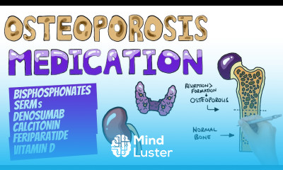 Osteoporosis Medications and Management Which Drugs Are Used To Treat Osteoporosis