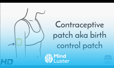 Contraceptive Patch aka Birth Control Patch
