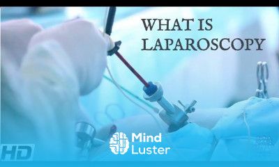 What Is Laparoscopy