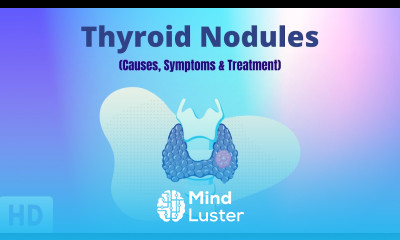Thyroid Nodules Causes Symptoms and Treatment