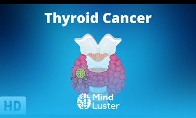 Thyroid Cancer Everything You Need to Know