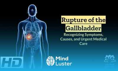 Ruptured Gallbladder Emergency Signs Causes and Lifesaving Tips