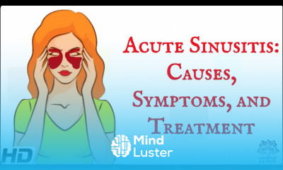 Acute sinusitis Everything you need to know