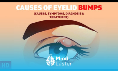 The Surprising Causes of Eyelid Bumps You Never Knew About